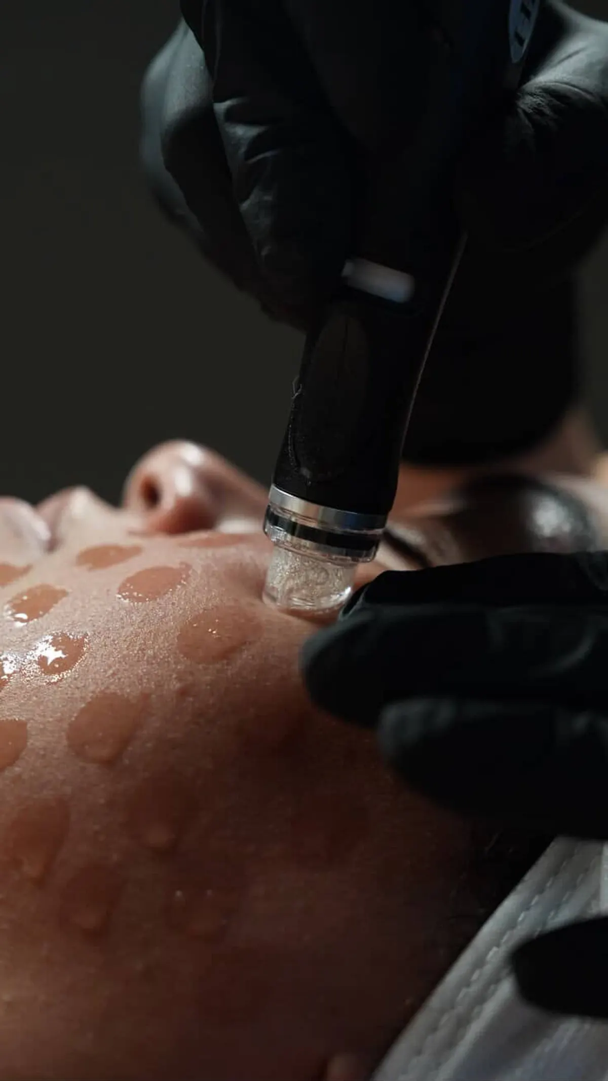 HydraFacial treatment at Skin Therapy