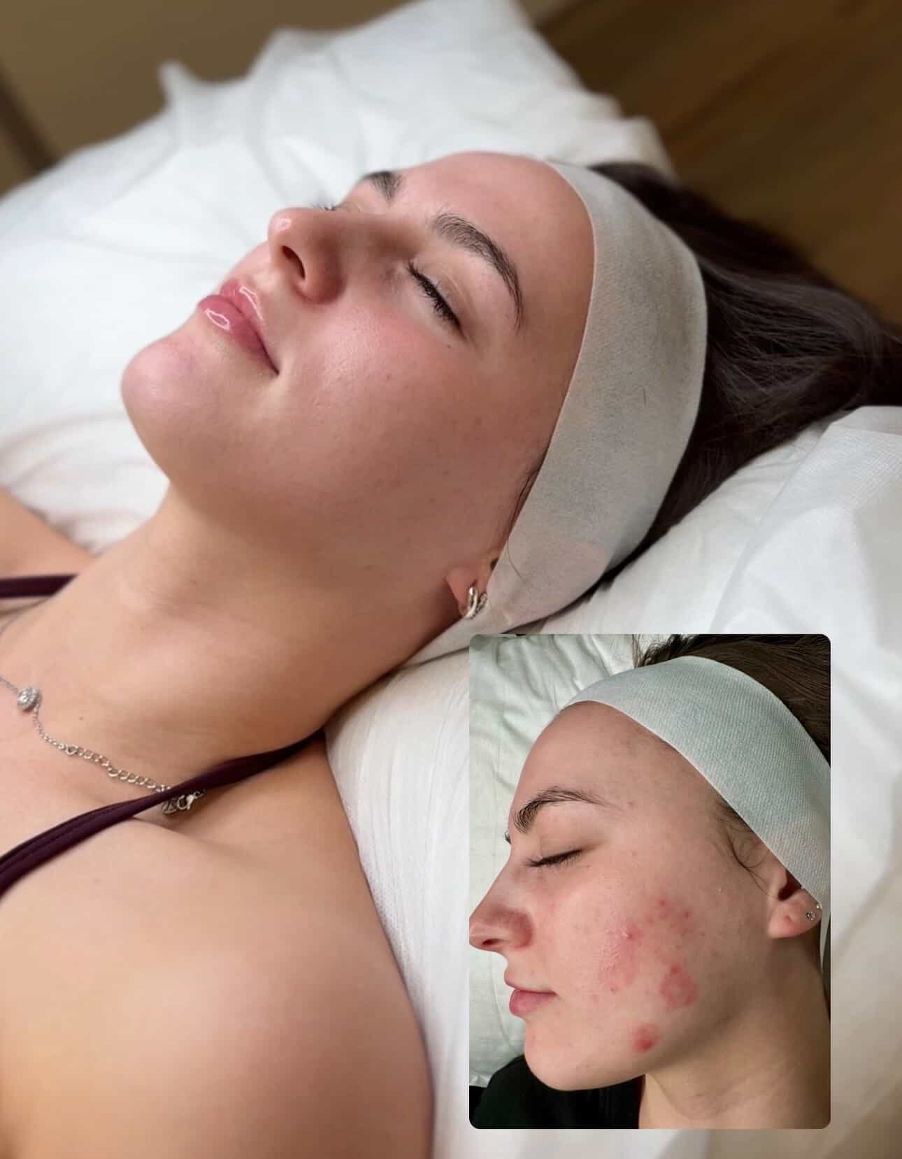 Skin Therapy client transformation 3