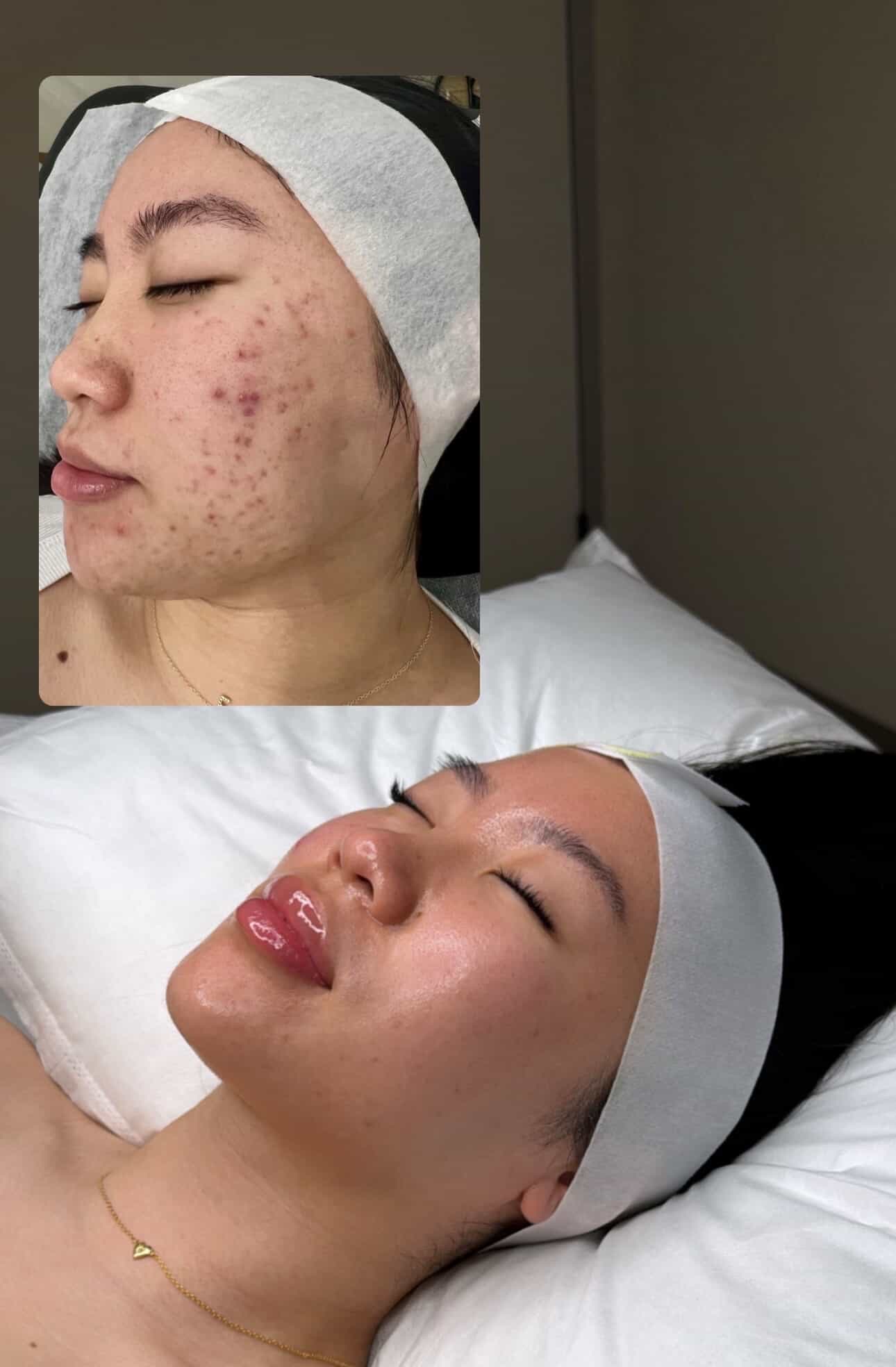 Skin Therapy client transformation 4